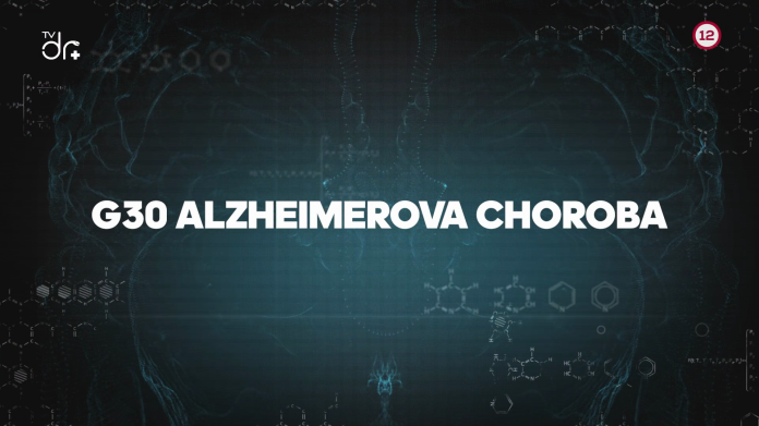 G30 Alzheimerova choroba