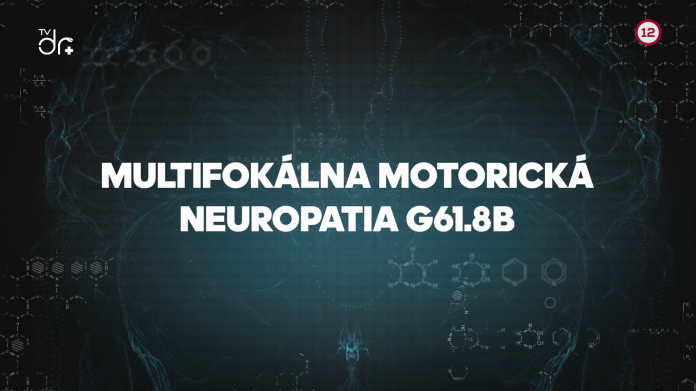 G61.8B Multifokálna motorická neuropatia